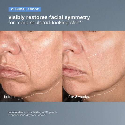 Dermalogica NeuroTouch Symmetry Serum – Firming & Sculpting Facial Serum (1 oz)