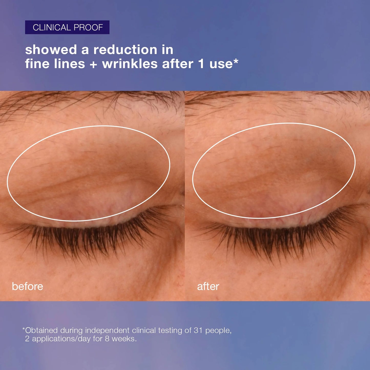 Dermalogica Phyto Nature Lifting Eye Cream – 0.5 oz